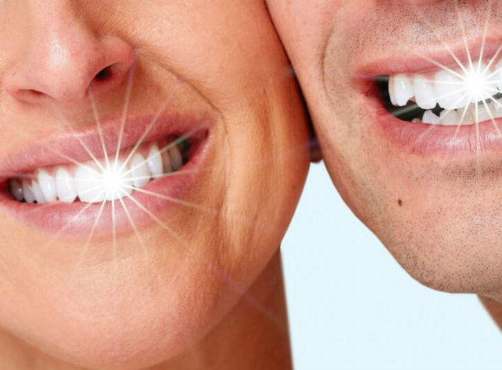 Come applicare un brillantino al dente