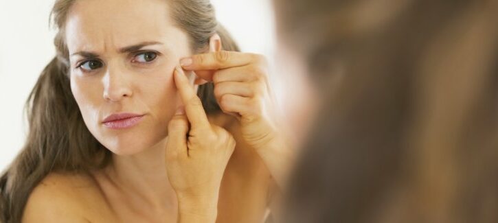 Come curare l'acne in inverno