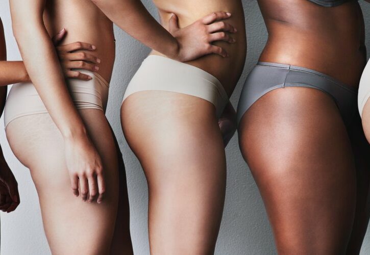Come eliminare le smagliature definitivamente: dalle creme al laser, tutti i metodi