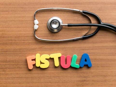 Come fare un impacco contro una fistola