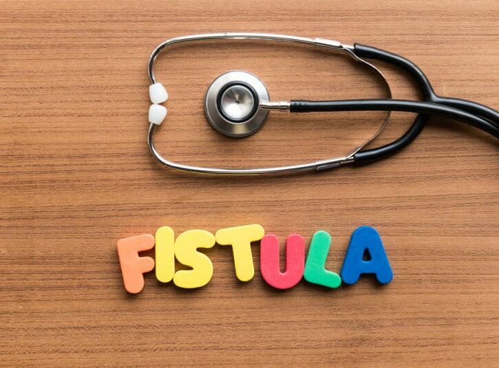 Come fare un impacco contro una fistola