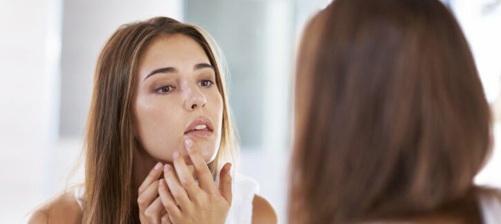 Come truccarti se hai l'acne