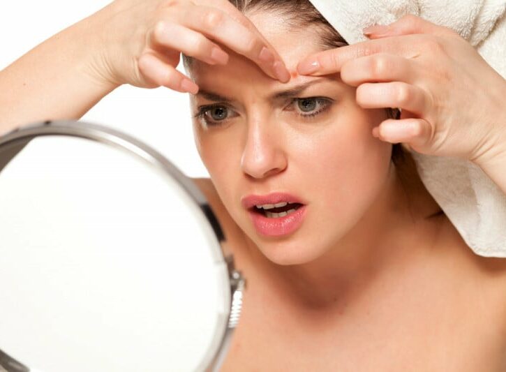 Come usare l'aloe vera per l'acne
