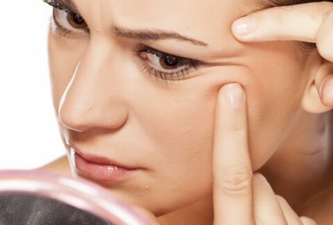 Acne: tutte le risposte alle tue domande