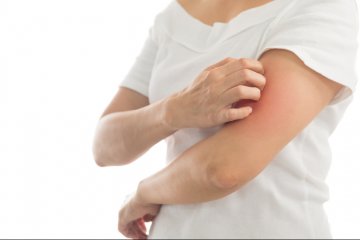 Malattie della pelle: quali sono le più diffuse e perchè sono in aumento