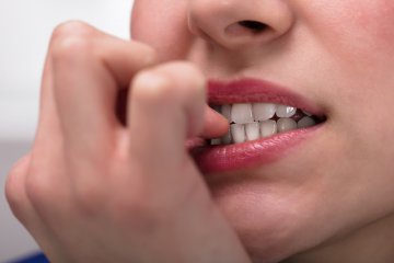 Onicofagia: come smettere di mangiarsi le unghie?