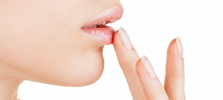 Come curare l'herpes con i rimedi naturali