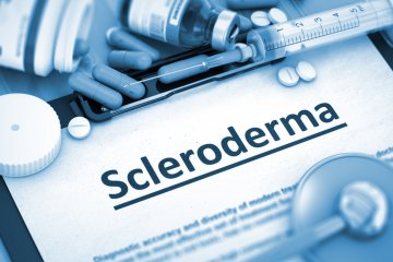 Sclerodermia: dai sintomi inziali alla diagnosi, quale cura?