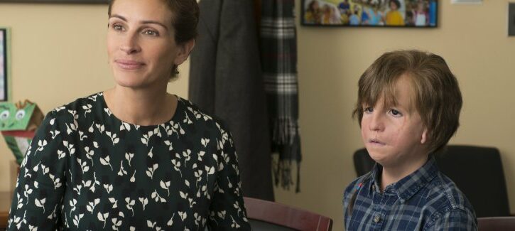 Sindrome di Treacher Collins: cos'è e quali sono le cause della malattia di cui soffre il protagonista di Wonder