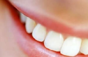 I migliori prodotti per denti bianchissimi