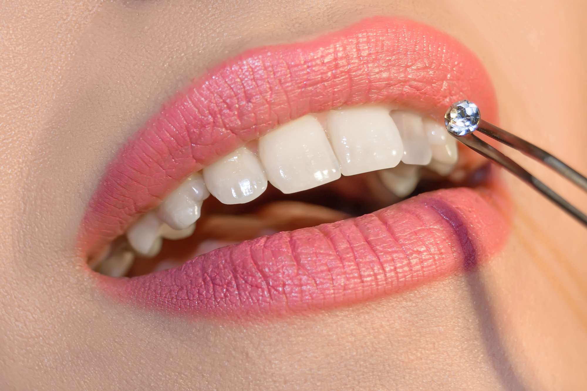 Tooth gems, scopri la moda dei brillantini sui denti - Donna Moderna