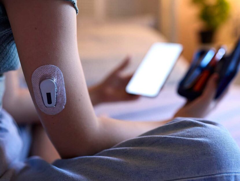 Sensore per la misurazione del diabete sul braccio di un ragazzo