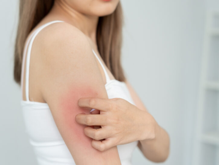 La celiachia della pelle e i disturbi ginecologici