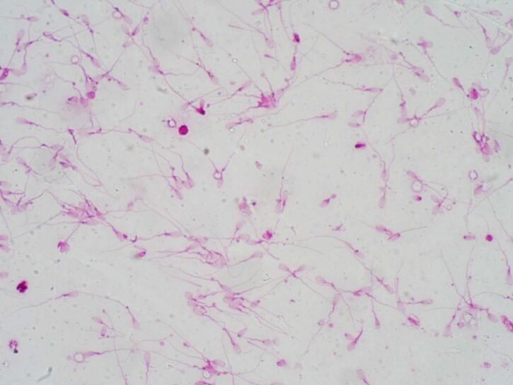 Spermatozoi in calo, è colpa degli insetticidi: la ricerca