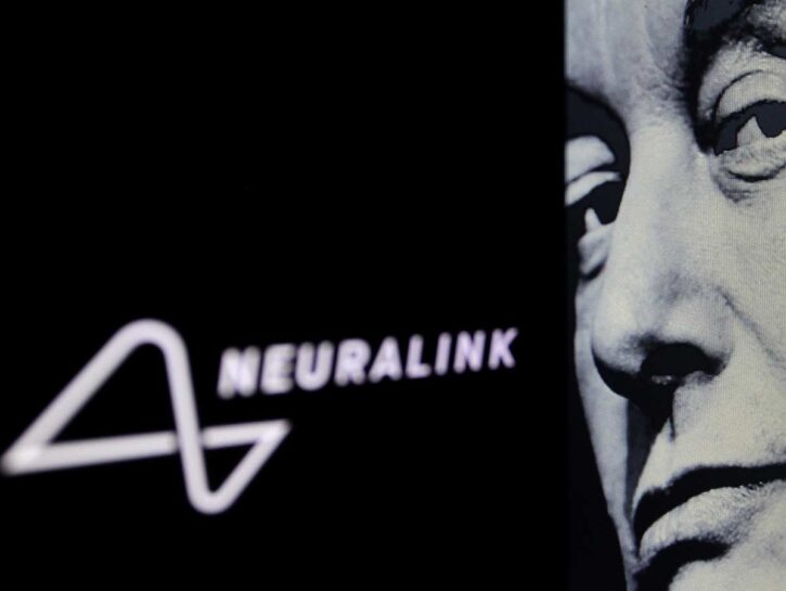 Telepathy, come funziona il primo chip impiantato nel cervello umano