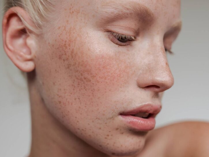 Skincare: inverno ciao ciao