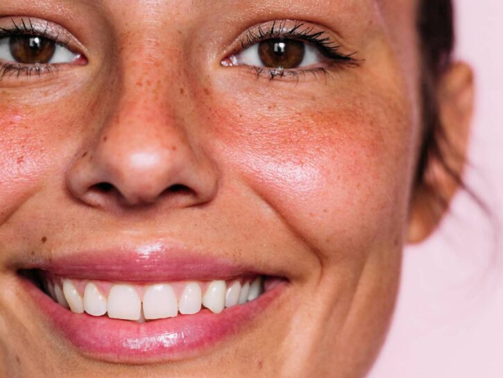 Novità per il sorriso delle donne