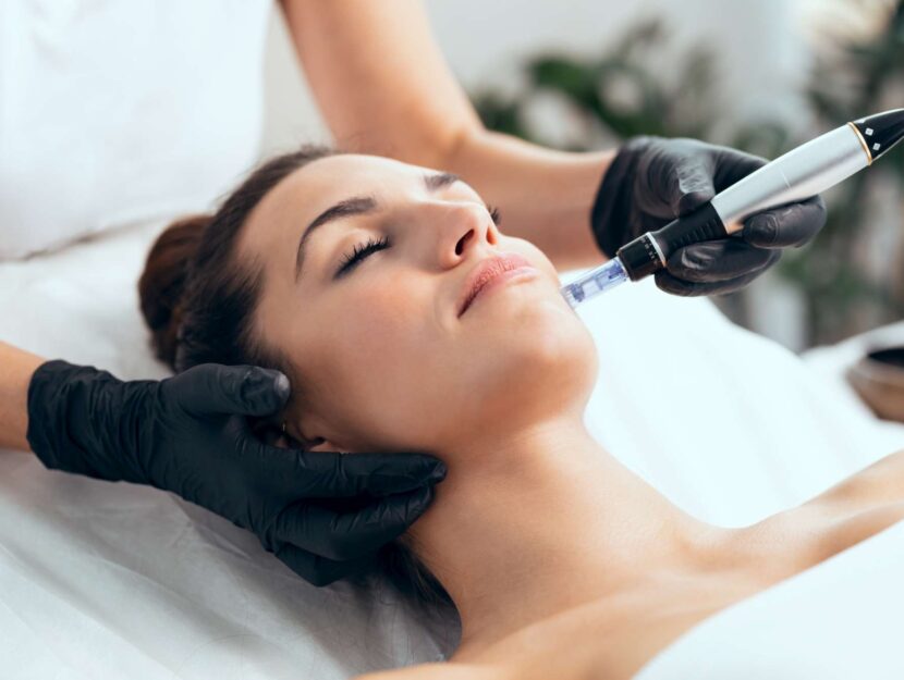 Microneedling