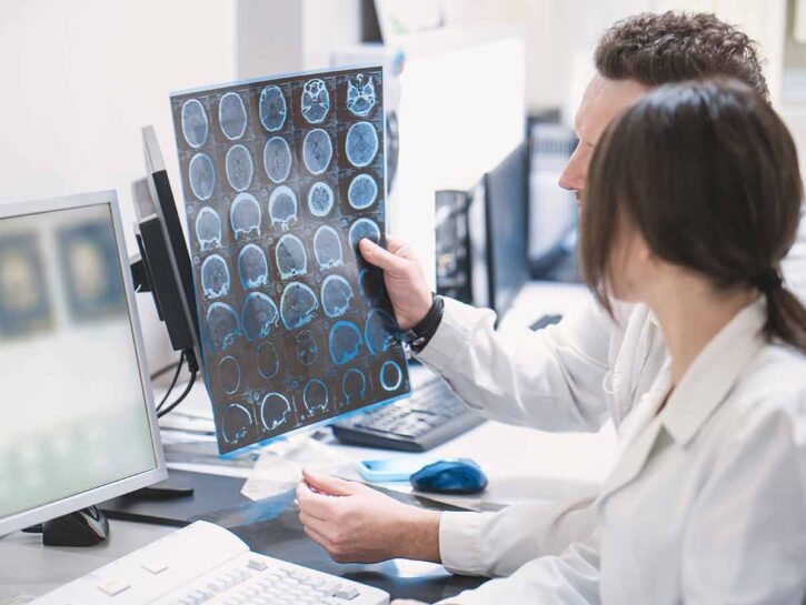 Ictus, in trent'anni casi aumentati del 70%