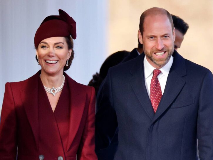 Cos’è il trapianto di barba ispirato al principe William