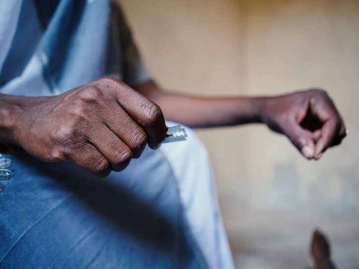Mutilazioni genitali femminili: i dati sono allarmanti