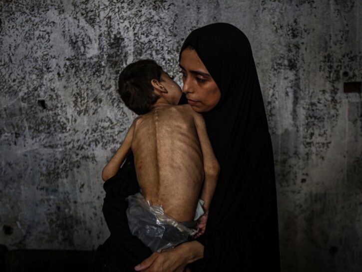 Gaza: serve accesso ai corridoi umanitari, il rischio di carestia è alto