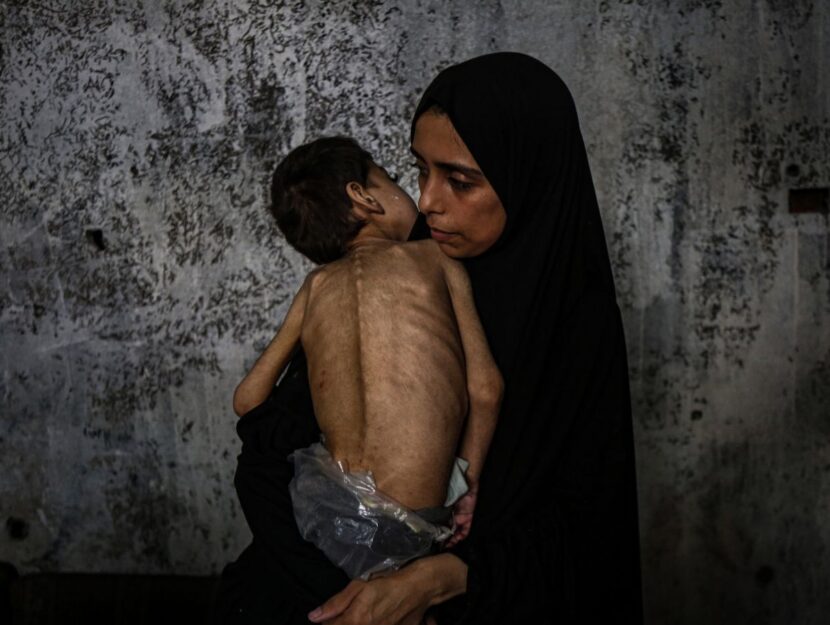 gaza carestia intervista