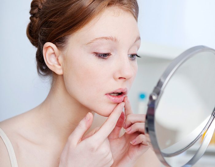 Herpes Ko Con Il Tea Tree Donna Moderna