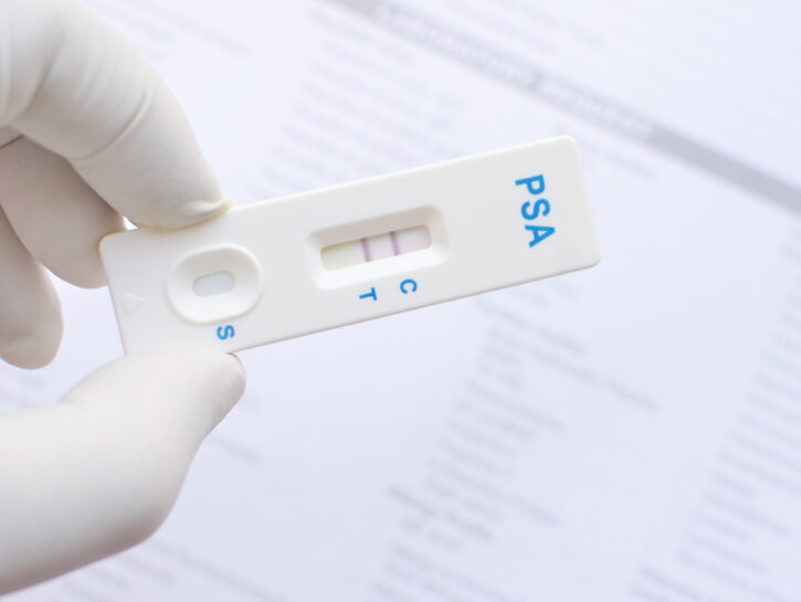 test psa per ingrossamento della prostata